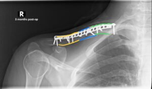 Creative Commons images