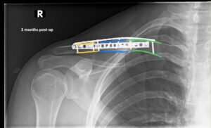 Creative Commons images