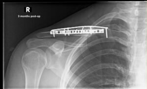 Creative Commons images