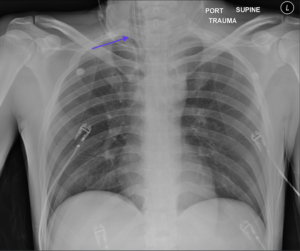 Creative Commons images