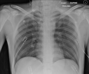 Creative Commons images