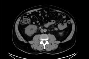 Creative Commons images