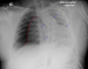 Creative Commons images