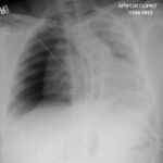 Creative Commons images