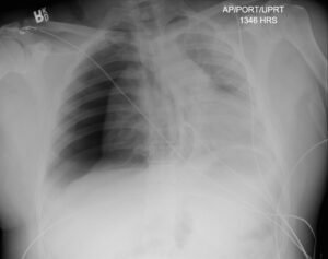 Creative Commons images