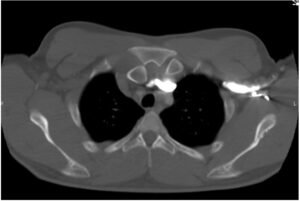 Creative Commons images