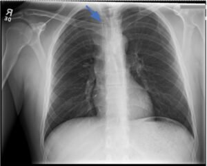 Creative Commons images