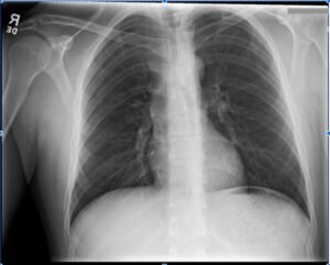 Creative Commons images