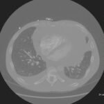 Creative Commons images