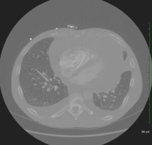 Creative Commons images