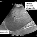 Creative Commons images