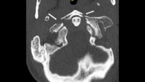 Creative Commons images