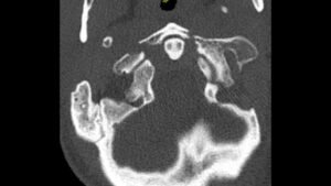 Creative Commons images