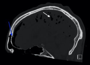 Creative Commons images