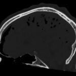 Creative Commons images