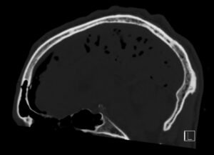 Creative Commons images