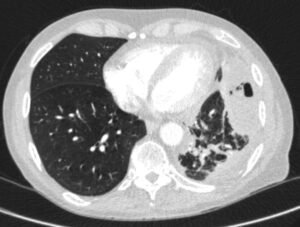Creative Commons images