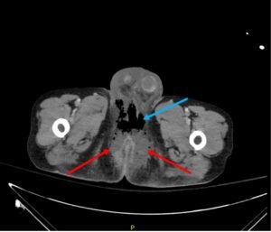 Creative Commons images