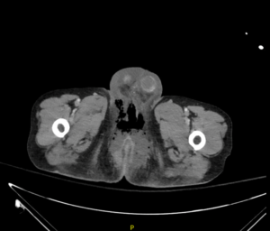 Creative Commons images