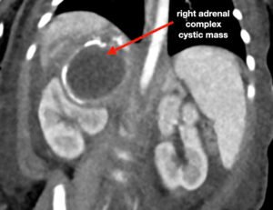 Creative Commons images