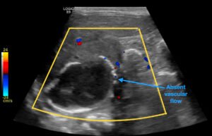 Creative Commons images