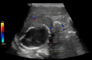 Creative Commons images