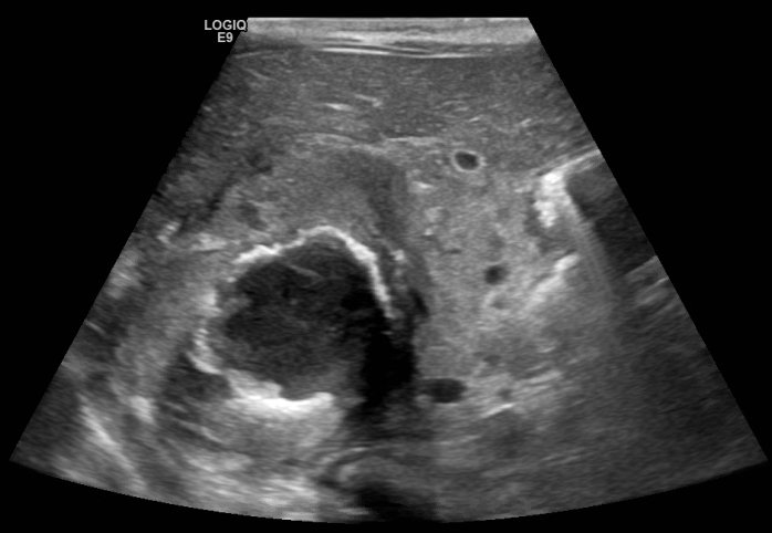 Creative Commons images