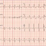 Creative Commons images