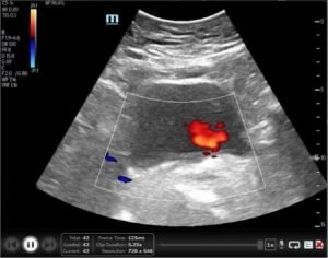 Creative Commons images