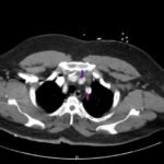 Creative Commons images