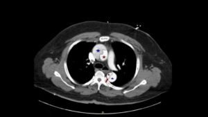 Creative Commons images