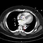 Creative Commons images