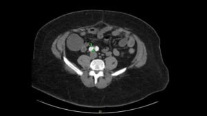 Creative Commons images