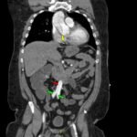 Creative Commons images