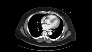 Creative Commons images