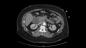 Creative Commons images