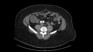 Creative Commons images