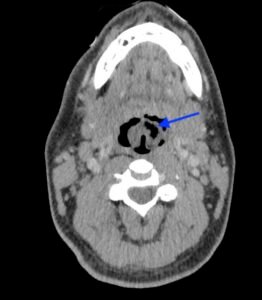 Creative Commons images