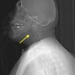 Creative Commons images