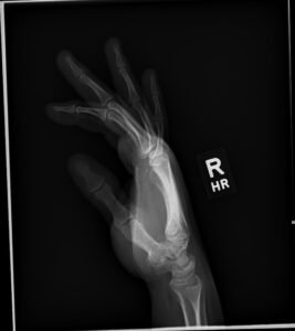 Creative Commons images