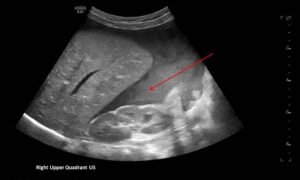 Creative Commons images