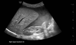 Creative Commons images