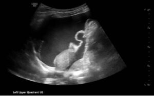 Creative Commons images