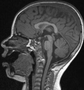 Creative Commons images