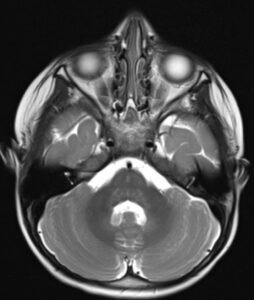 Creative Commons images