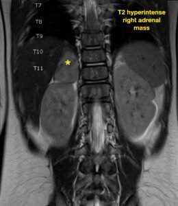 Creative Commons images