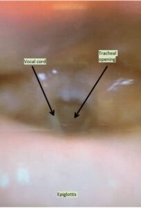 Creative Commons images