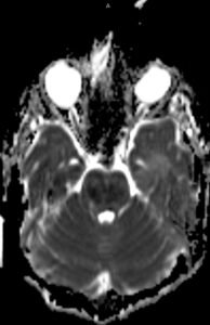 Creative Commons images