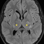 Creative Commons images