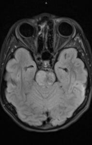 Creative Commons images